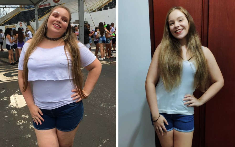 Hannah em dois tempos: antes do emagrecimento e após rotina de exercícios